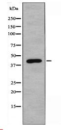 CBX6 Antibody