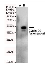 Cyclin D2 Mouse mAb