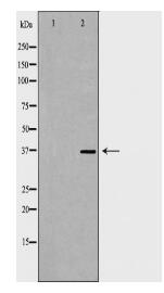 ACP5 Antibody