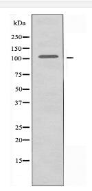 Actinin α-2/3 Antibody