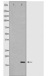 CALM1 Antibody