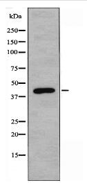 ABHD8 Antibody