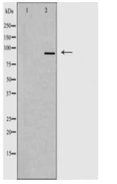 DDX20 Antibody