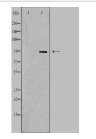 BMX Antibody