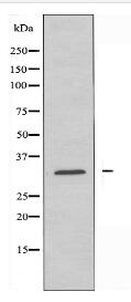 AIBP Antibody