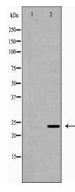 CLDN7 Antibody