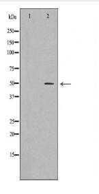 AP2M1 Antibody
