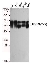Keratin(50-60kDa) Mouse mAb