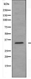 CA5A Antibody