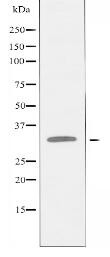 CCBP2 Antibody