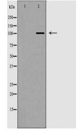AP2A2 Antibody