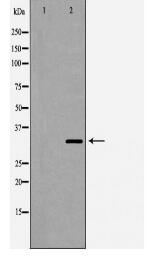 AIMP1 Antibody