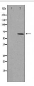 CAMKK2 Antibody