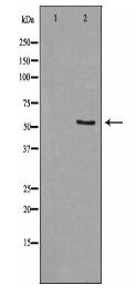 CNR1 Antibody