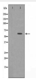 ATP6V1B1 Antibody