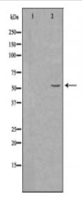 BAIAP2L2 Antibody