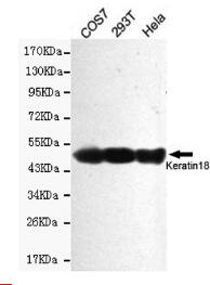 Keratin 18 Mouse mAb