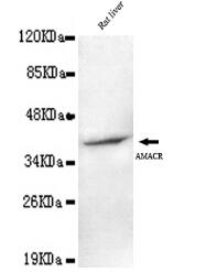 AMACR(C-term) Mouse mAb