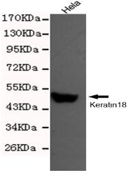 Keratin18 Mouse mAb