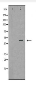 GLUL Antibody