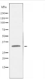 AQP12 Antibody