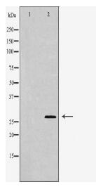 CD99 Antibody