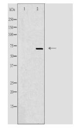 ADCK2 Antibody