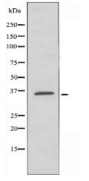AKR1CL2 Antibody