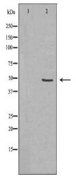 CSF2RA Antibody