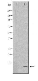 CCL5 Antibody