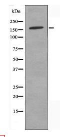 Collagen IV α2 Antibody