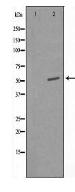 ALPL Antibody