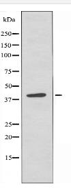 CLN6 Antibody