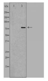 CAPN12 Antibody