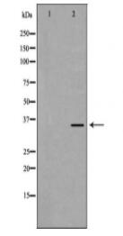 EFNB2 Antibody