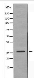 ANP32C Antibody