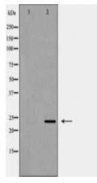 EBAG9 Antibody