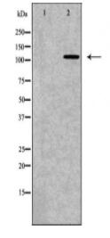BMPR2 Antibody
