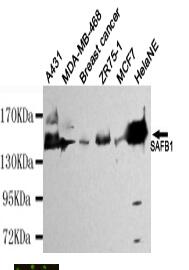 SAFB1 Mouse mAb