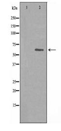 ACRBP Antibody