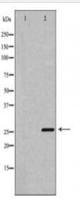 Bcl-2 Antibody