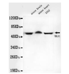 TBLR1 Mouse mAb