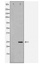 APCS Antibody