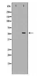 CETP Antibody
