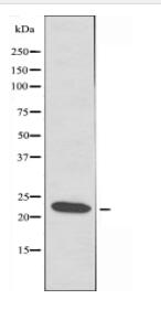 ATP5S Antibody