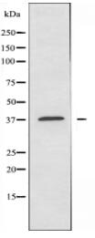 CA12 Antibody