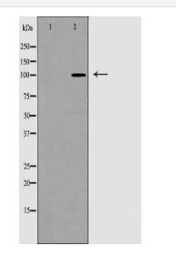 ACTN1 Antibody