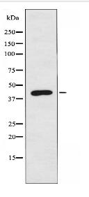 CLN5 Antibody