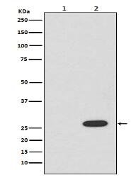 RFP Antibody