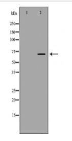 BTRC Antibody